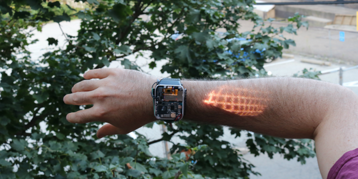 Apple Watch Killer Is Here!